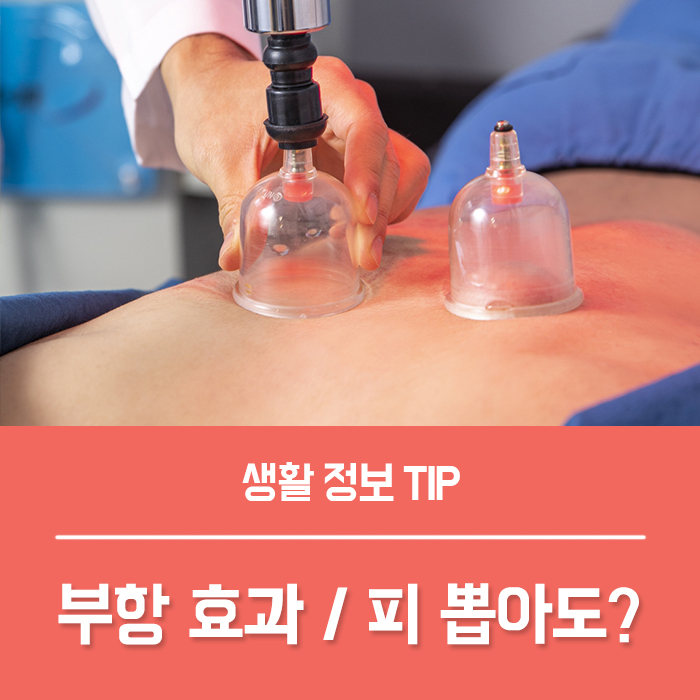 부항 효과 부황 원리 피빼는 부항(습부항) 부작용은?