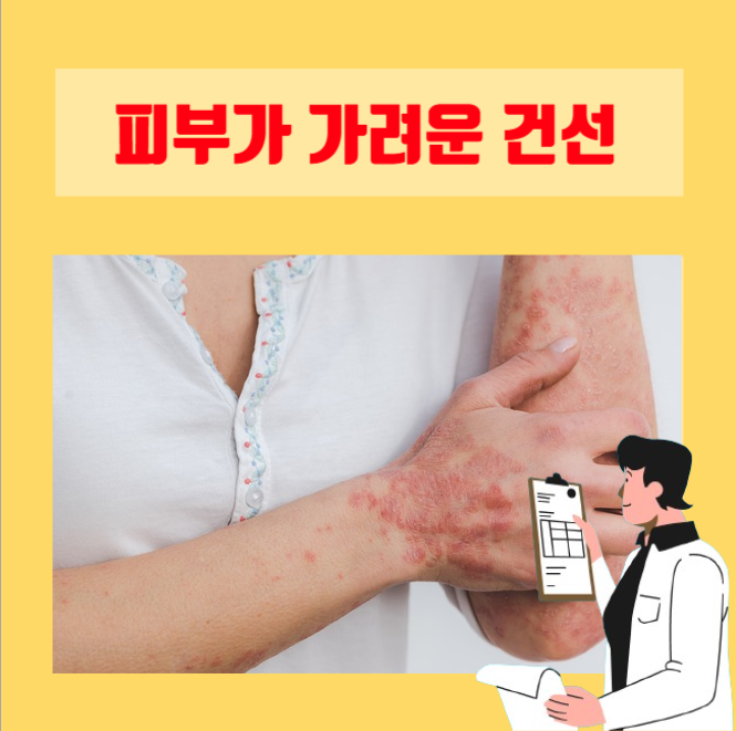  [이학박사] 피부가 가렵고 건조해서 생기는 건선