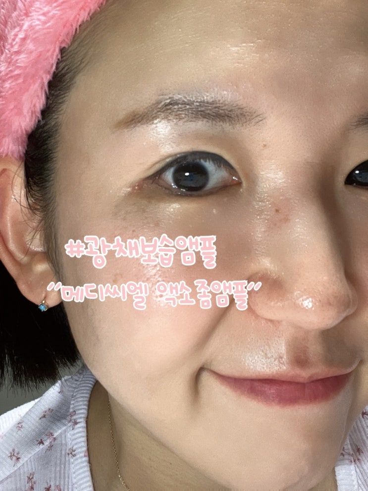  광채보습앰플 메디씨엘 액소좀앰플 추천합니다