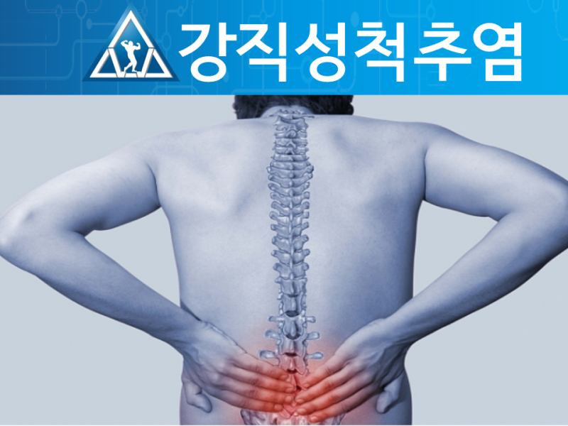 강직성 척추염 원인 및 증상 완화를 위한 주사 약 치료법