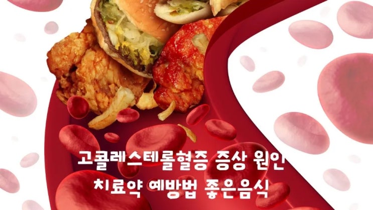  고콜레스테롤혈증 무엇? 수치 원인 증상 예방법 약 음식