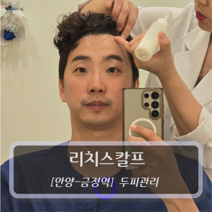  [안양-금정역, 두피관리] 리치스칼프 안양두피관리