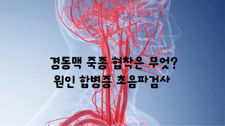  경동맥 죽종 협착증 무엇? 원인 초음파검사 치료기준 합병증 증상