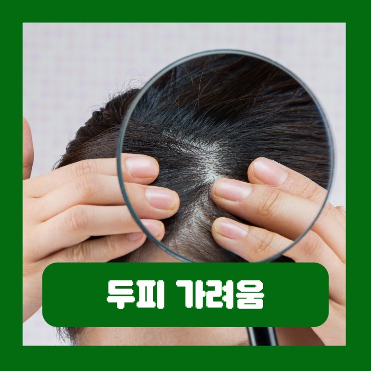  두피 가려움 원인 환절기 염색 각질 해결법 병원 피부과 샴푸