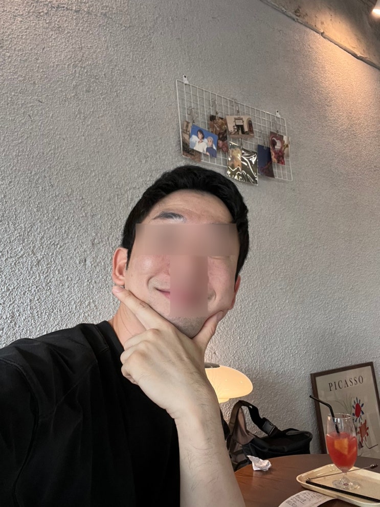 홍대쥬베룩 남자 피부관리 포텐자콜라스터 효과 및 통증 리얼 후기