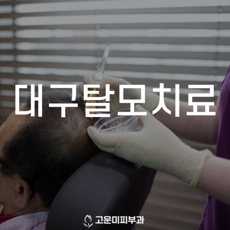  대구탈모치료 조금씩 빠지는 머리카락 빨리 치료하는 것이 중요합니다