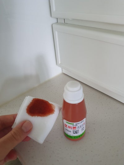 회음부 피지낭종 제거 병원 수술 후기
