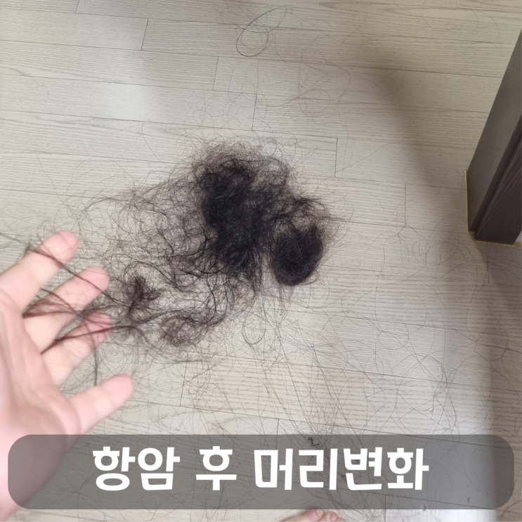  유방암3기 항암 후 머리 빠짐부터 1년 6개월 머리 변화, 탈모