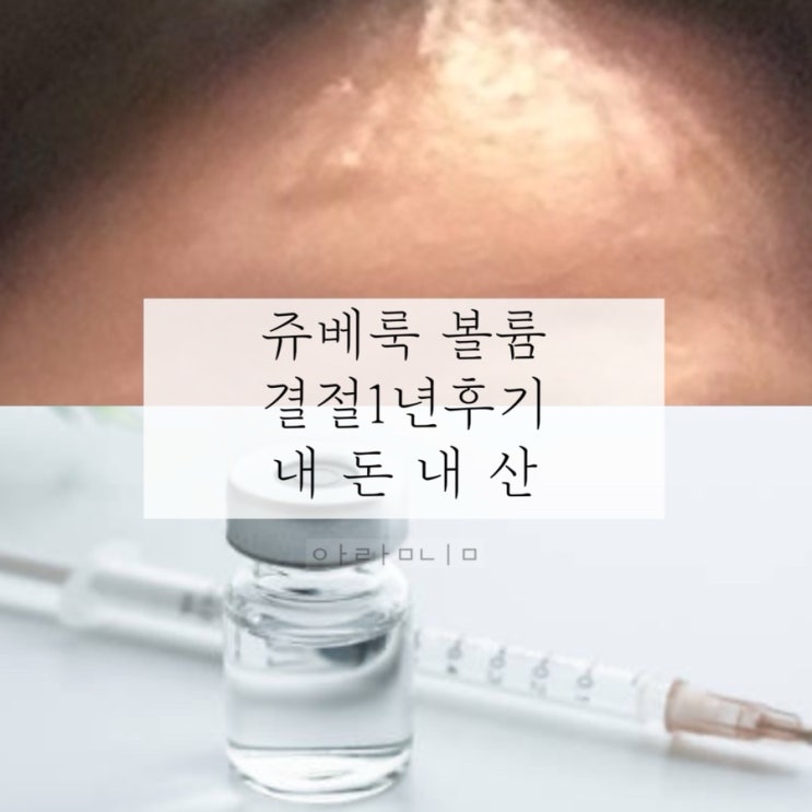 쥬베룩 볼륨 부작용 눈밑 결절 | 1년 후기 | 내돈내산