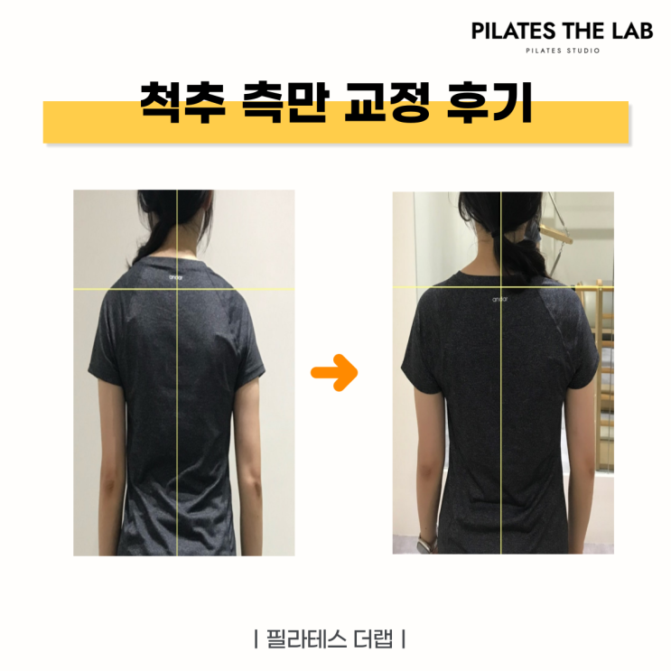  목동 필라테스 척추 측만 교정 후기