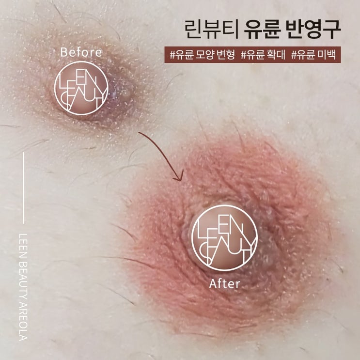  유두 유륜문신 잘하는곳 일상생활 바로 가능 자연스러운 결과