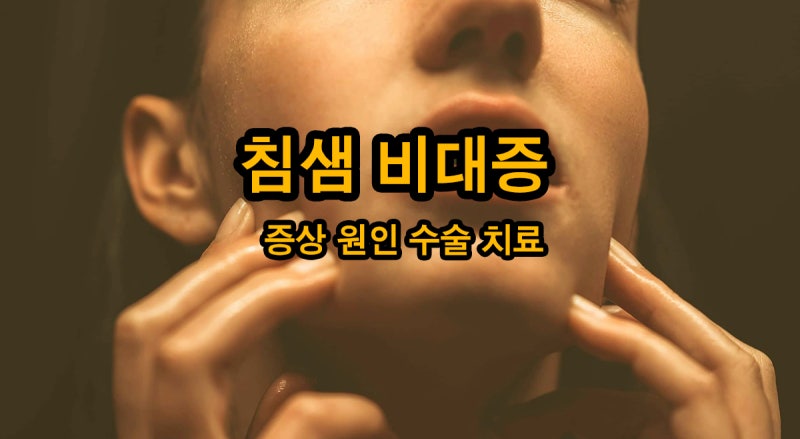 침샘 비대증 증상 원인 수술 치료 전에 자가 관리 방법