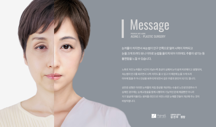  중년의 눈성형은 달라야 합니다. Part 1
