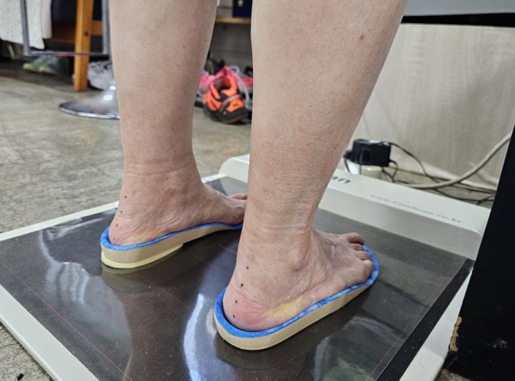  나이가 들었다고 허리가 쉽게 꼬부라지는 것은 당연한 걸까? (대구 족부 재활 전문 센터)