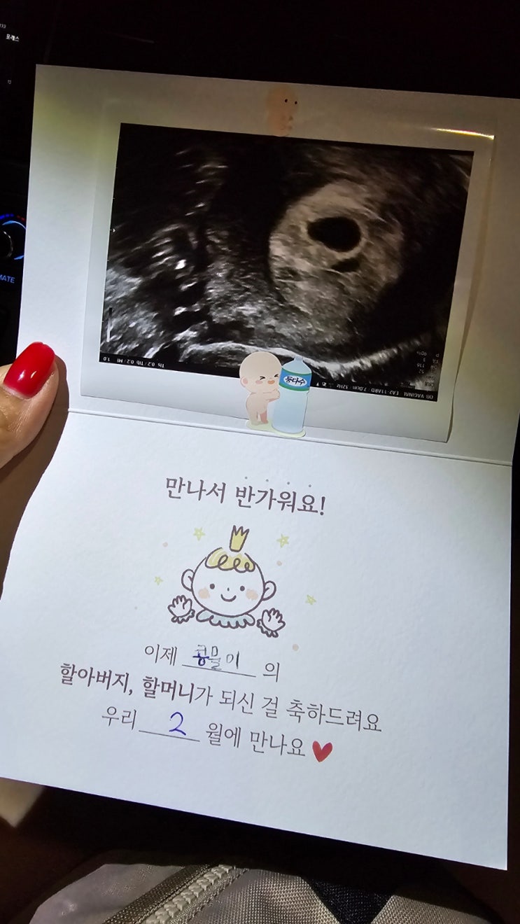  중원구보건소 임밍아웃 출산 꾸러미 선물