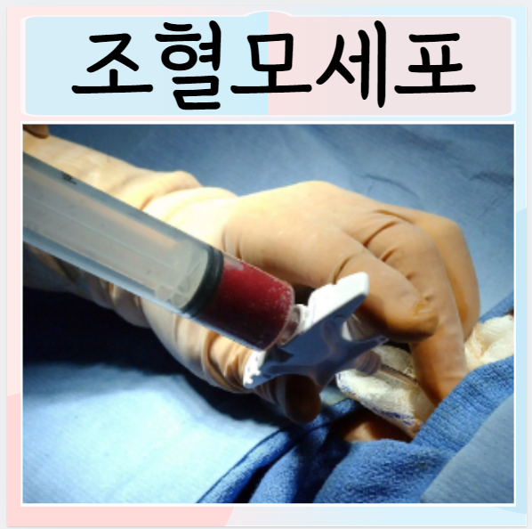  조혈모세포 이식 기증시 알아야할 필수 사항 부작용