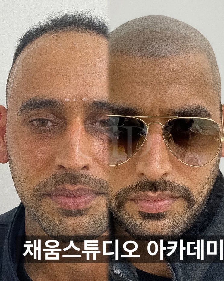  광주머리문신 연예인들이 받는 이유