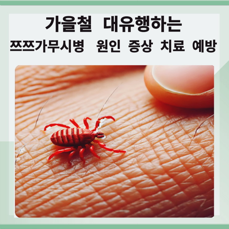  가을철 대유행하는 쯔쯔가무시병