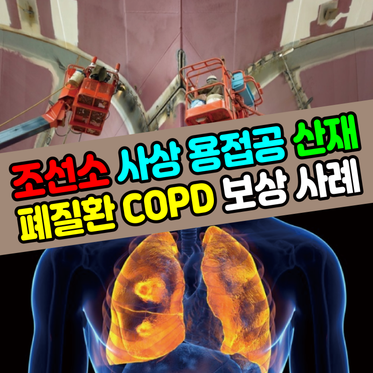  [대구/부산/거제/울산 노무사] 조선소 사상 용접공 산재 COPD 만성폐쇄성폐질환 보상 사례