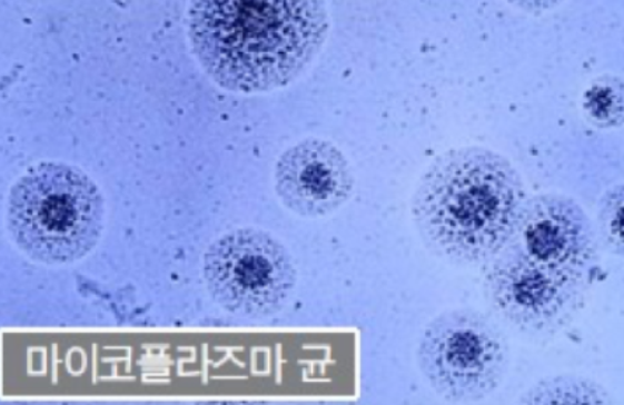 마이코플라즈마 폐렴 증상 원인 치료 총정리