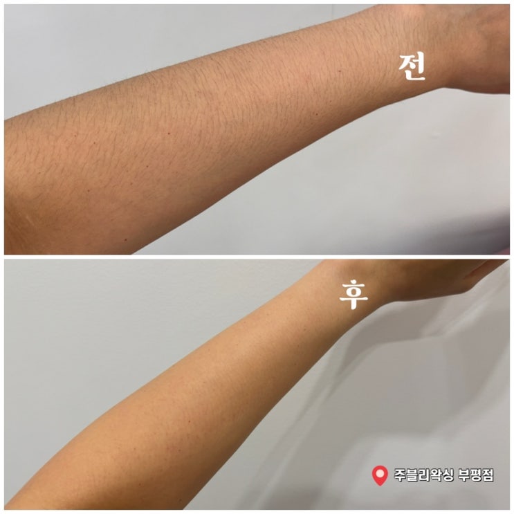  부평역 왁싱 주블리왁싱 부평점 자신감 있는 깔끔한 아래팔 만든 후기