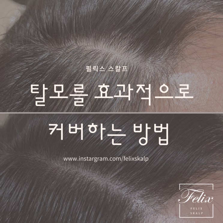  구래동 양곡 두피문신 작업을 통해 자신감을 되찾은 40대 여성의 이야기