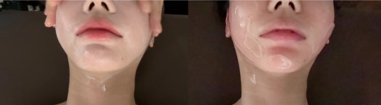  잠실피부관리 송파에스테틱 조이스킨앤스파 윤곽관리 대만족 후기