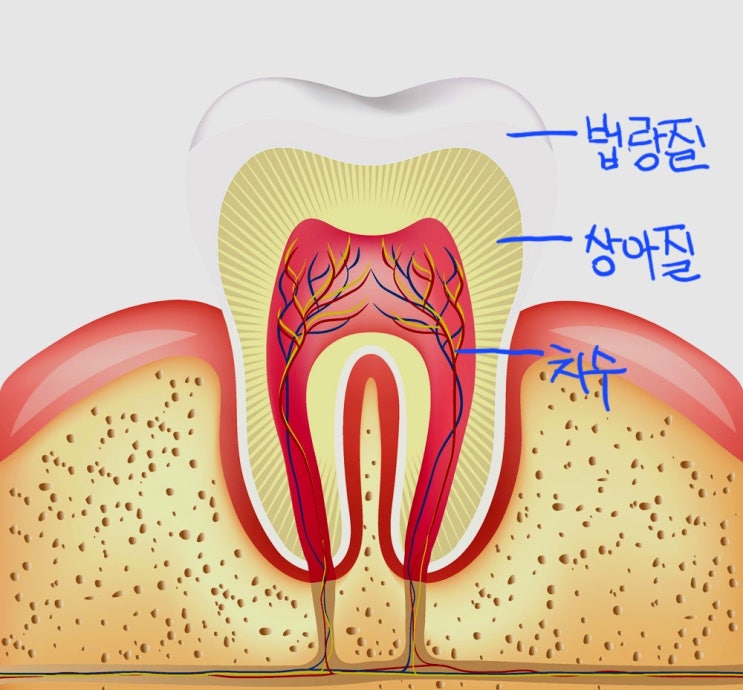  치아인레이 한 번 했다고 방심하면 큰돈 나가요