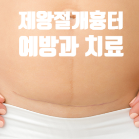  산후복부의 피부변화와 관리 (4) 제왕절개수술 흉터의 예방과 치료