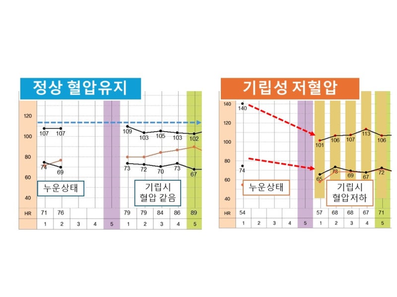[부산신경과] 자율신경기능검사 방법과 정확한 해석