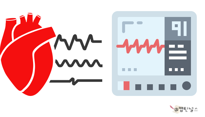 A-fib RVR EKG 모양 및 특징 그리고 PSVT와 A-fib RVR 차이점 : 네이버 블로그