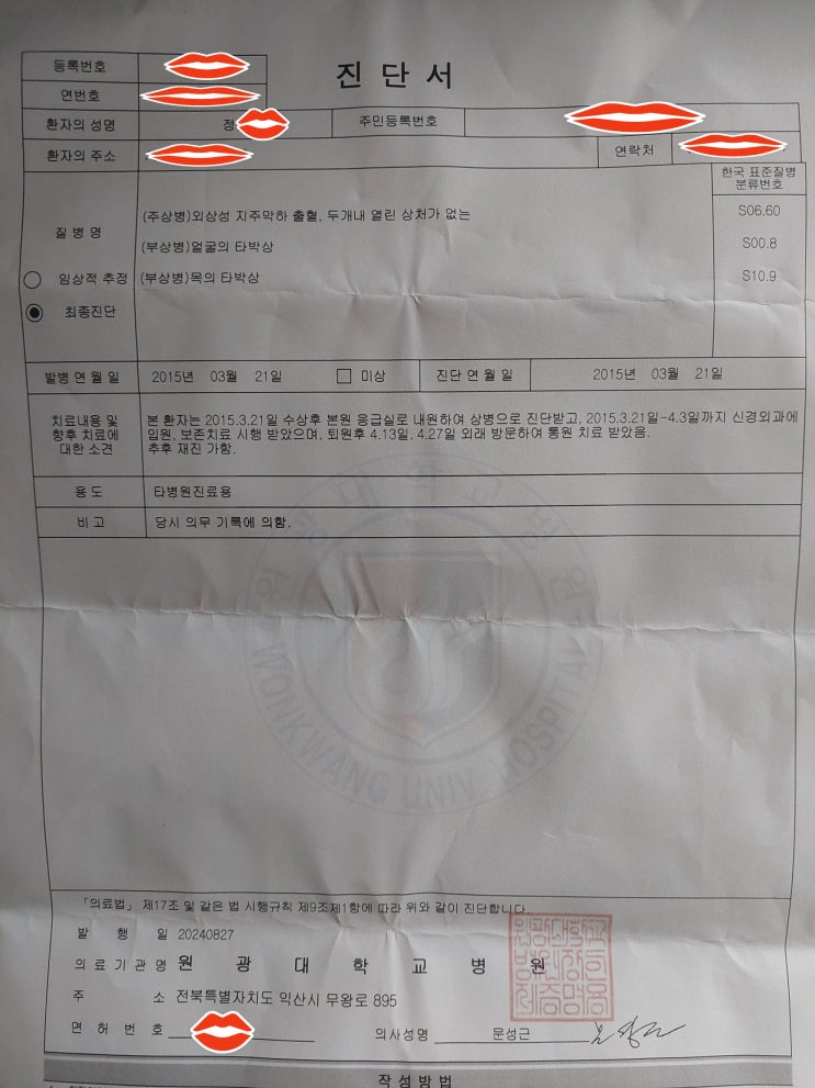  松山 2015년 폭행 사건 2024-08-27  원광대학교 병원 신경외과 지주막하출혈 진단서 발급 (전치 6주 생략 발급함 이유가? 타병원진료용?)
