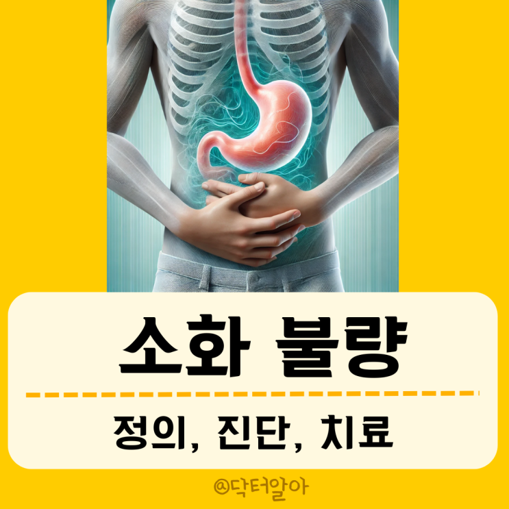  기능성 소화불량(functional dyspepsia)의 정의, 진단 및 치료