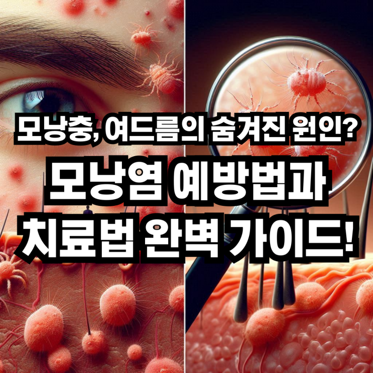  모낭충, 여드름의 숨겨진 원인? 모낭염 예방법과 치료법 완벽 가이드!