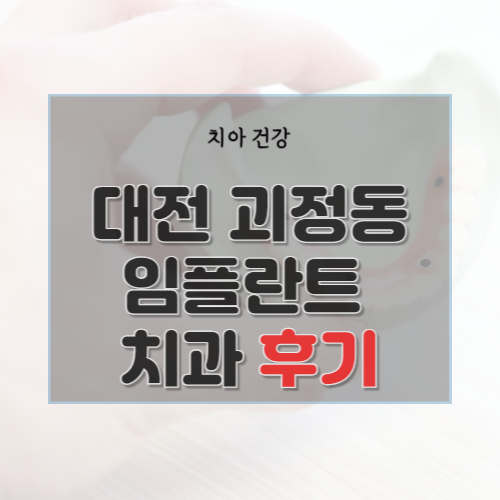  대전 괴정동 치과 임플란트 종류 가격 및 실제 후기 9곳 총정리