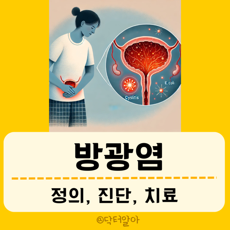  급성 방광염(acute cystitis)의 정의, 증상, 진단 및 치료