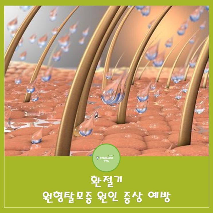  계절의 변화와 머리카락: 환절기 원형탈모증의 원인,증상,예방