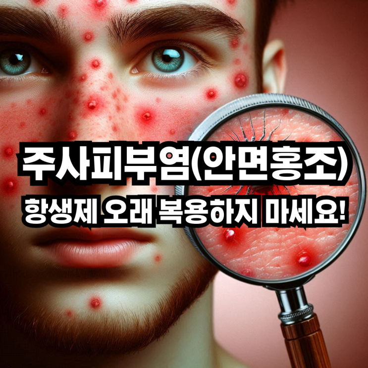 주사피부염(안면홍조), 항생제 오래 복용하지 마세요! 모낭충 원인과 효과적인 치료법