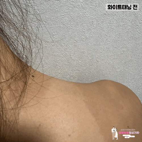  감일화이트태닝 '태닝나우 하남감일점' 화이트태닝 6회차 전, 후 비교