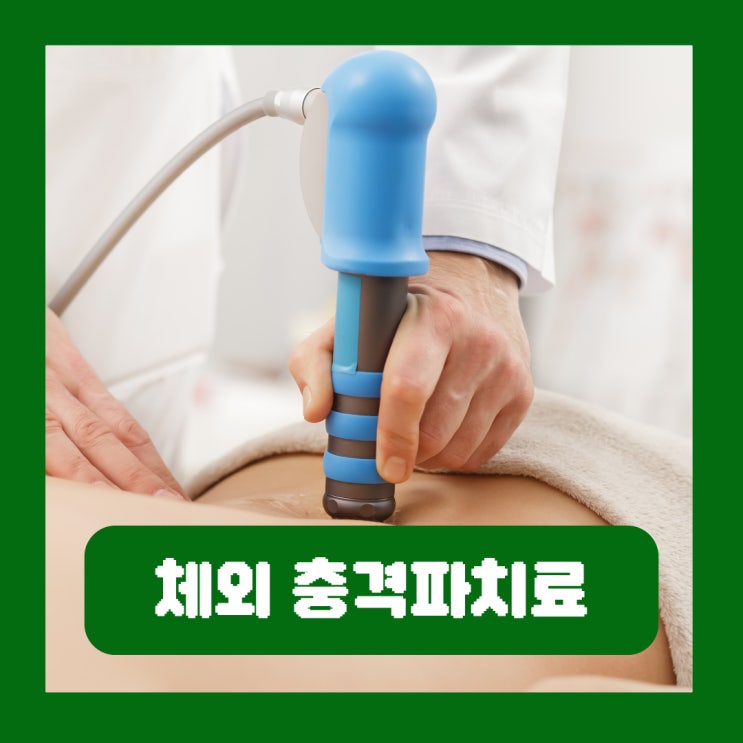  체외 충격파치료 가격 실비 주기 횟수 원리 통증