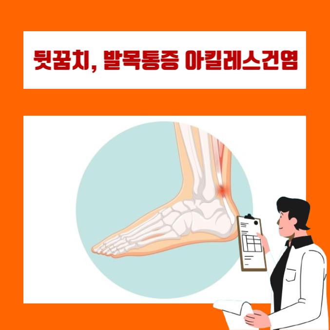 뒷꿈치 통증과 발목 통증은 왜 발생할까? 아킬레스건염