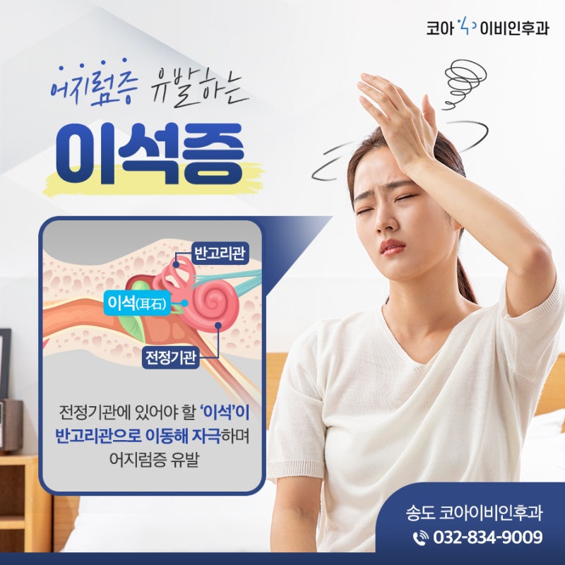 이석증 비행기 타도될까요? 치료 방법은?