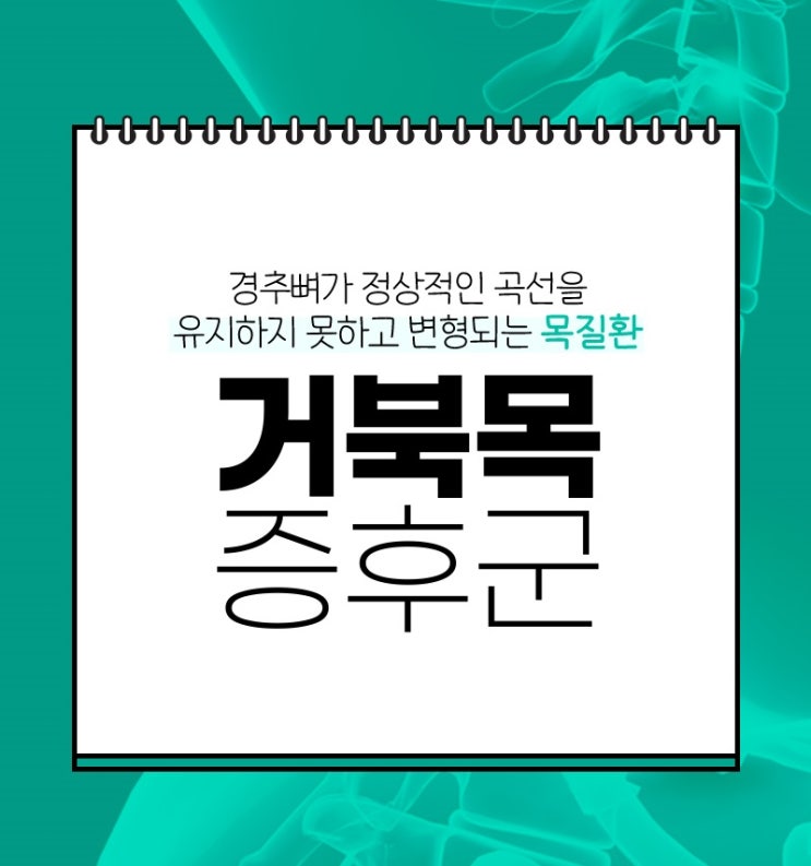  강서구정형외과 목이 뻣뻣해지는 현대인의 질병 거북목증후군 증상 및 예방법