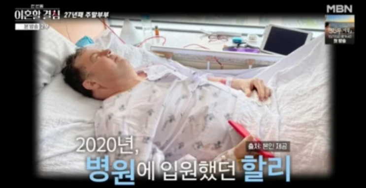 <b>로버트 할리</b> "<b>희귀암</b>으로 근육이 다 녹았다"… 충격적인 얼굴... 