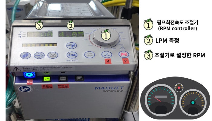 에크모(ECMO) 치료방법 및 적응증과 ECMO 구조 : 네이버 블로그