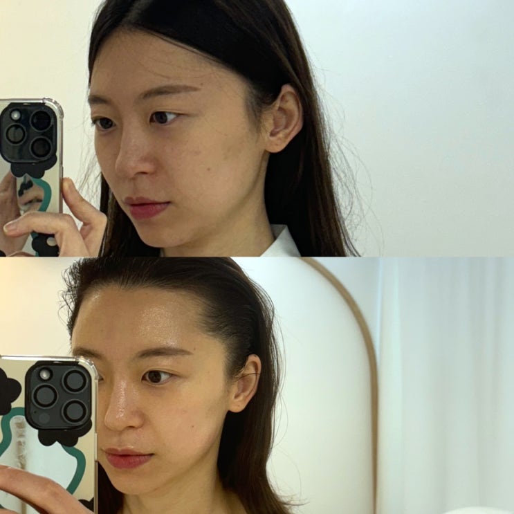  홍대 피부관리 비치나 에스테틱 웨딩케어 끝판왕 마포 윤곽관리