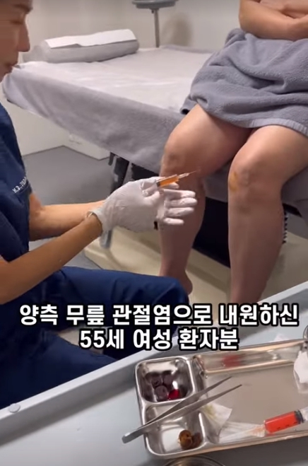 50대 퇴행성 관절염 환자 줄기세포 무릎 주사 치료 스토리