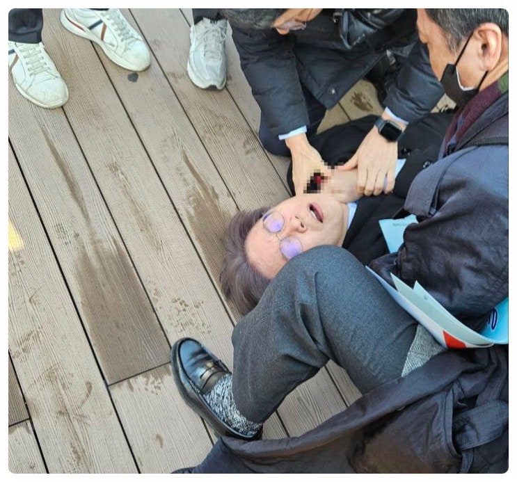 <b>이재명</b> <b>부산 방문</b> 일정 중 피습 목찔림 긴급의료조치