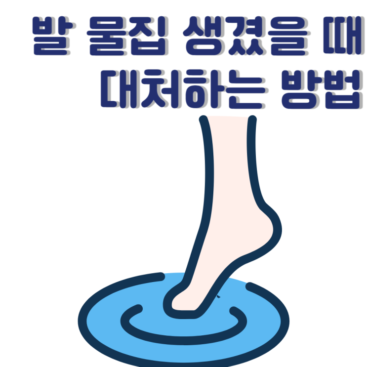  발에물집생겼을때 대처하는 방법 3가지