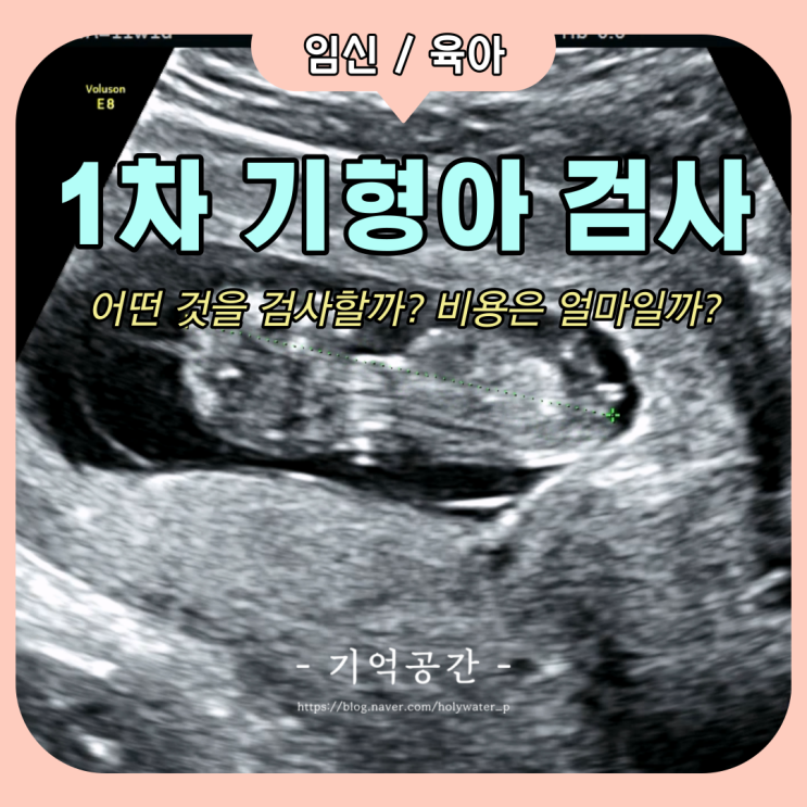 [임신 11주차] 1차 기형아검사는 무엇을 검사할까? 비용은 얼마일까? (Integrated Test)